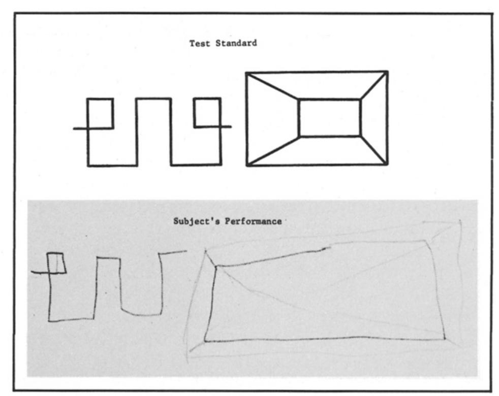 Visual Inattention Balloon Test (PDF) Hemi-Inattention Resulting from Left Hemisphere Brain Damage ...