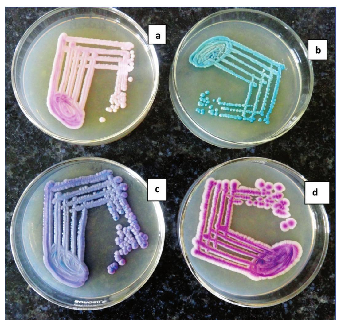 Not Well Developed (PDF) Isolation, Identification and Antifungal Susceptibility Testing ...