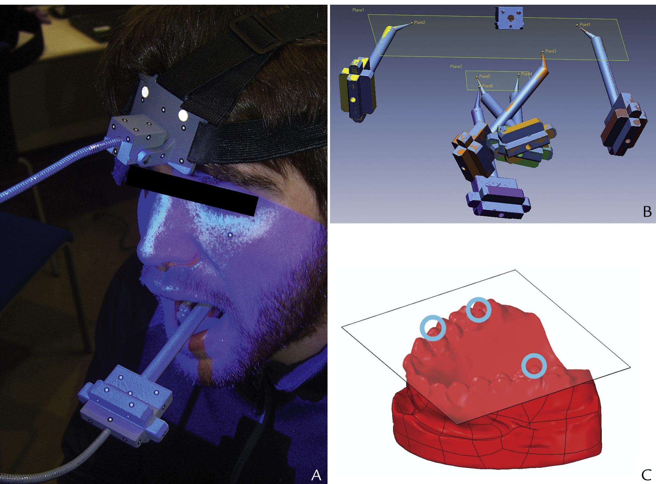 (PDF) Comparison of the accuracy of a 3-dimensional virtual method and ...