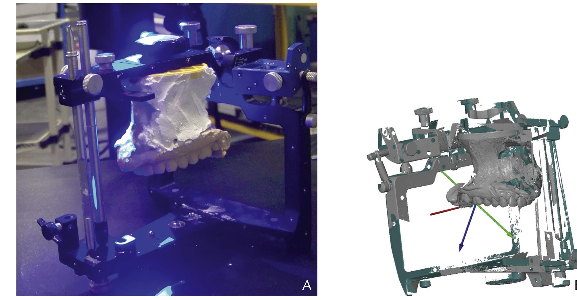 (PDF) Comparison of the accuracy of a 3-dimensional virtual method and ...