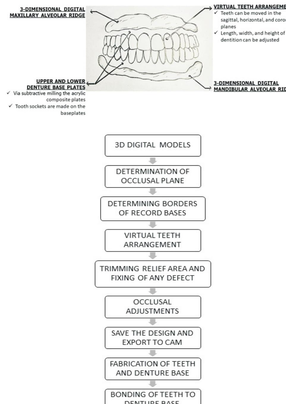 Digital denture — diagrammatic representation steps for