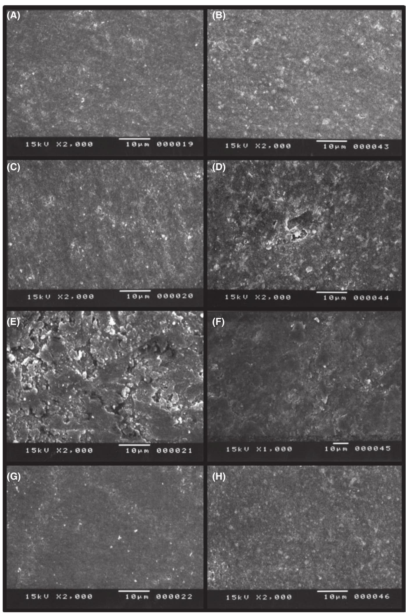 (PDF) Comparison of different polishing methods on the surface ...