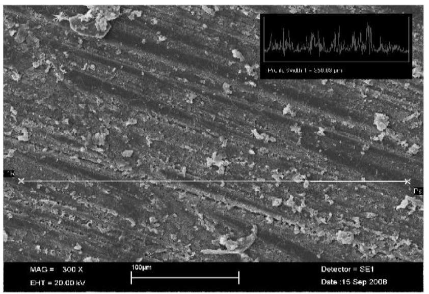 Scanning electron micrograph shows the surface roughness of