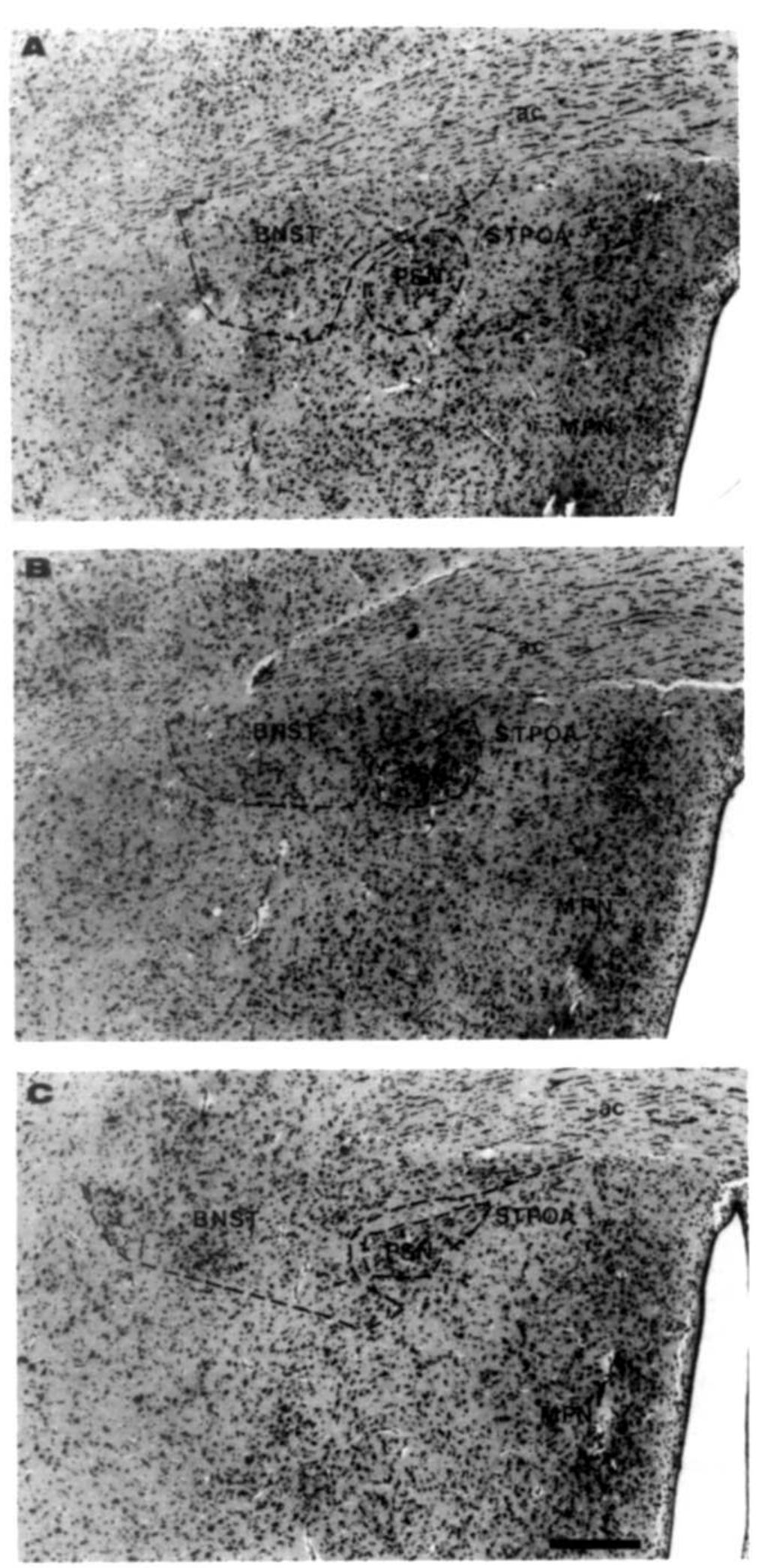 (PDF) Sexual dimorphism in the parastrial nucleus of the rat preoptic area