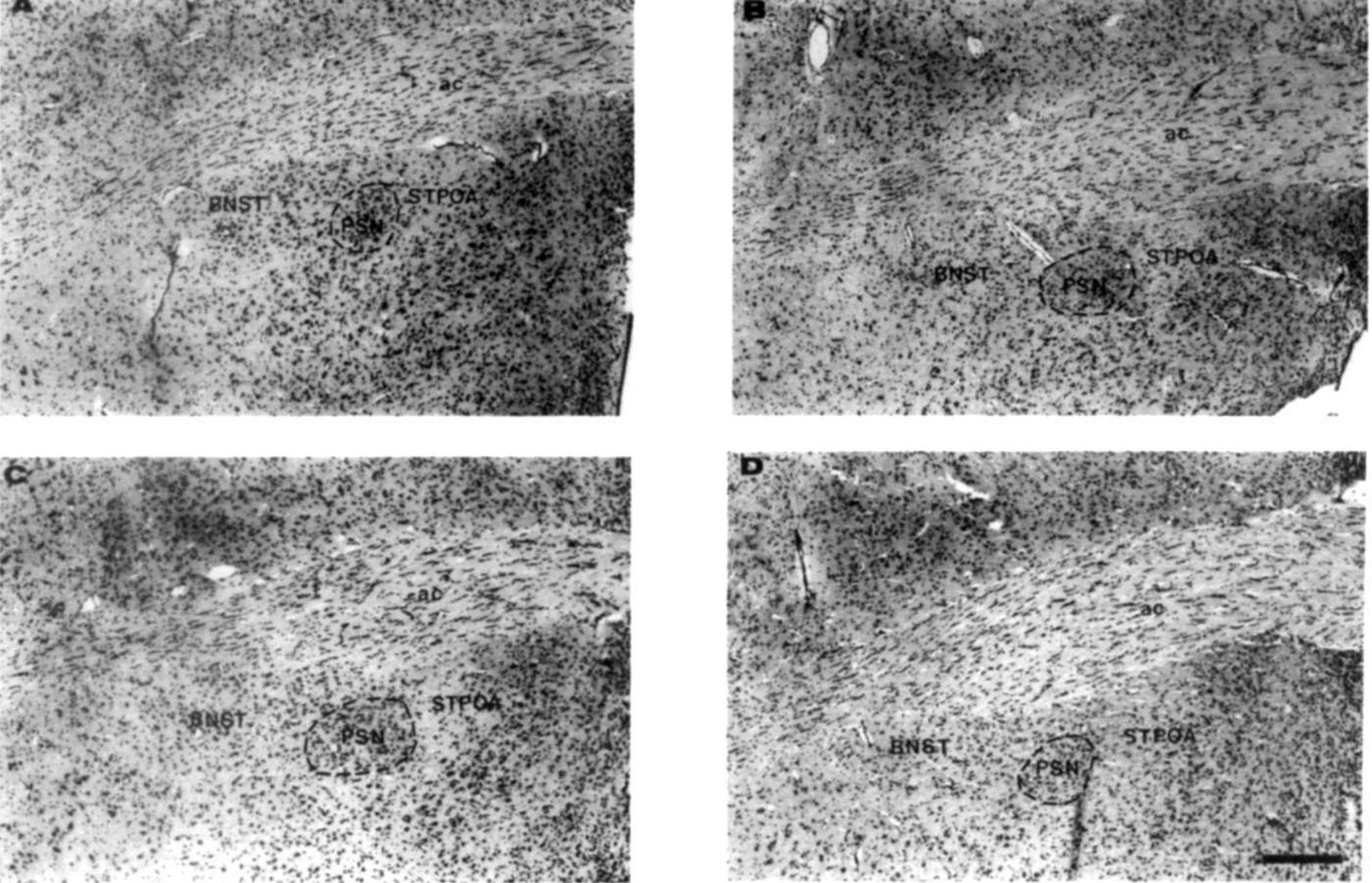 (PDF) Sexual dimorphism in the parastrial nucleus of the rat preoptic area