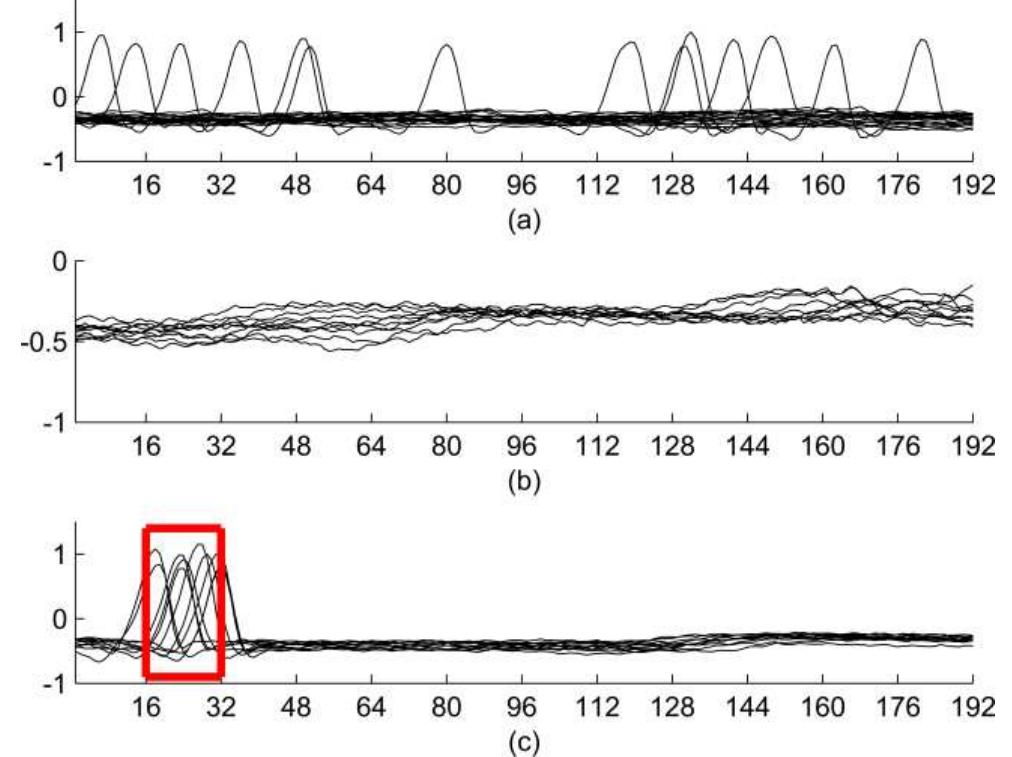 (PDF) Adaptive Dictionary Reconstruction for Compressed Sensing of ECG ...