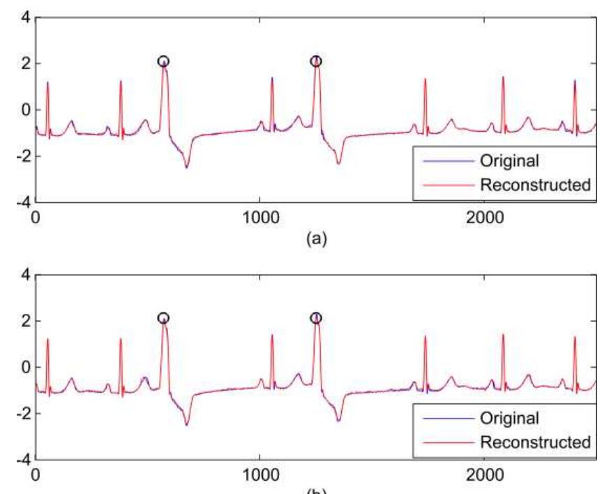 (PDF) Adaptive Dictionary Reconstruction for Compressed Sensing of ECG ...