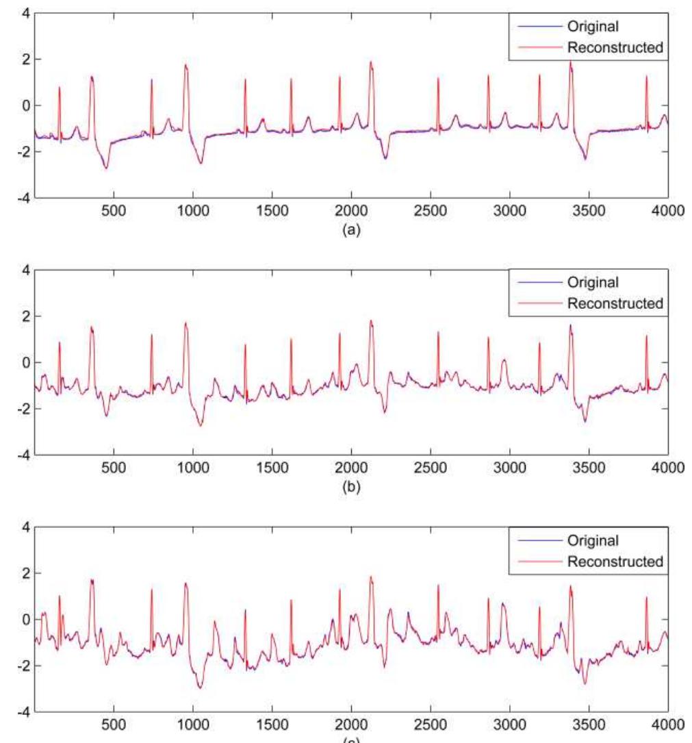 (PDF) Adaptive Dictionary Reconstruction for Compressed Sensing of ECG ...