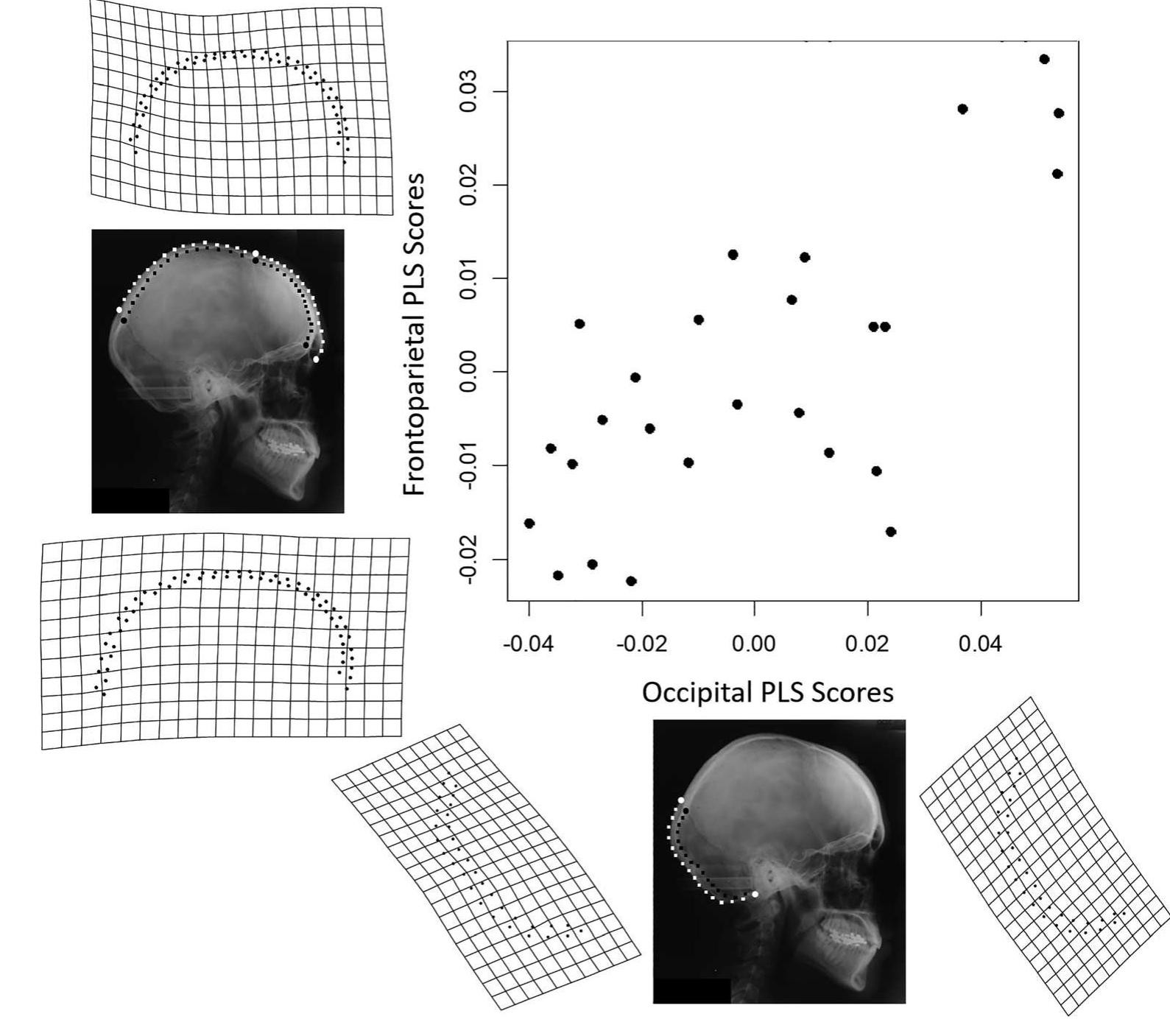 Bun Development (PDF) Occipital hemi‐bun development and shape covariation in a ...