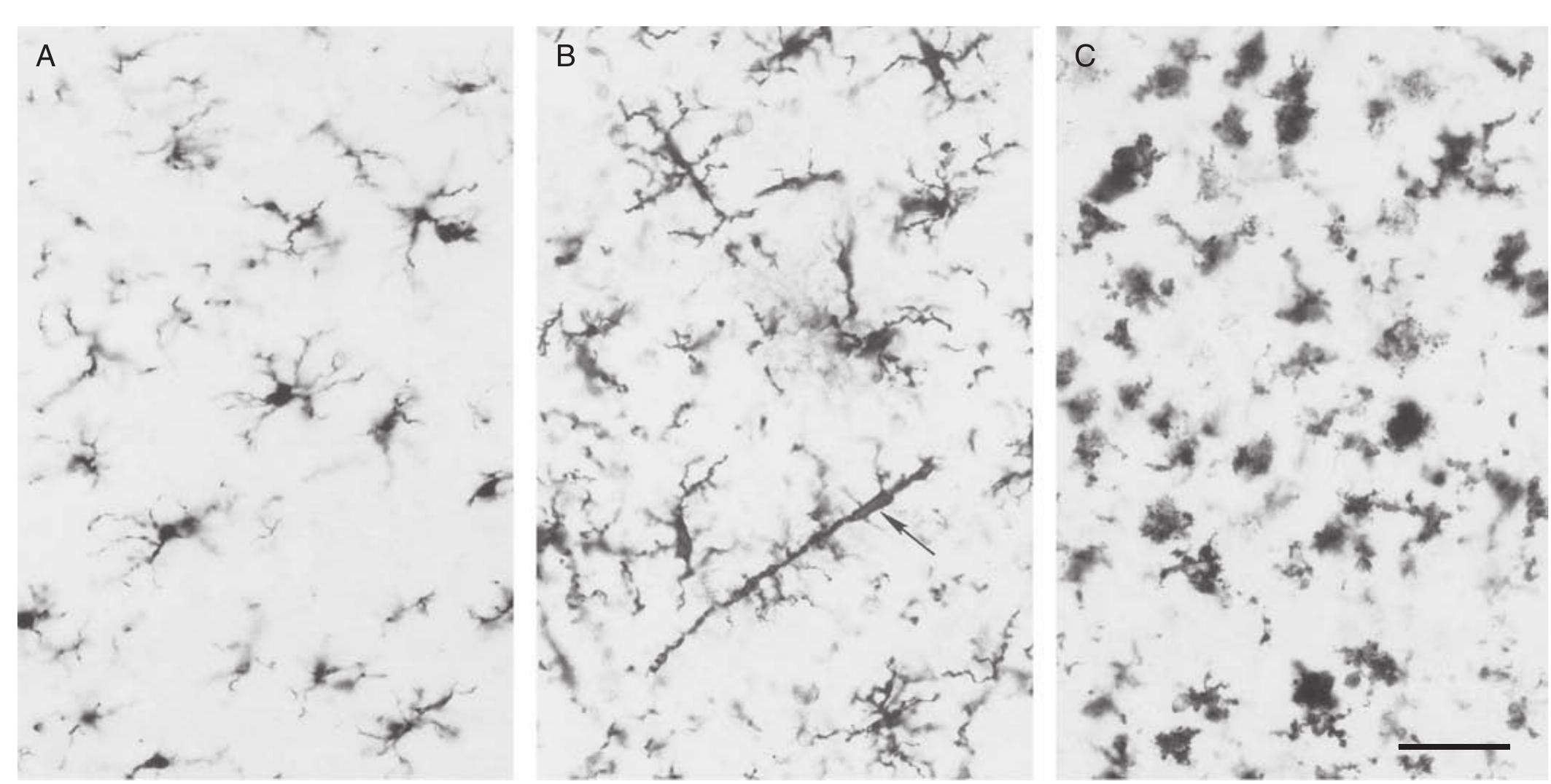 Normal Microglia 12 activation of microglial cells in a tissue section from