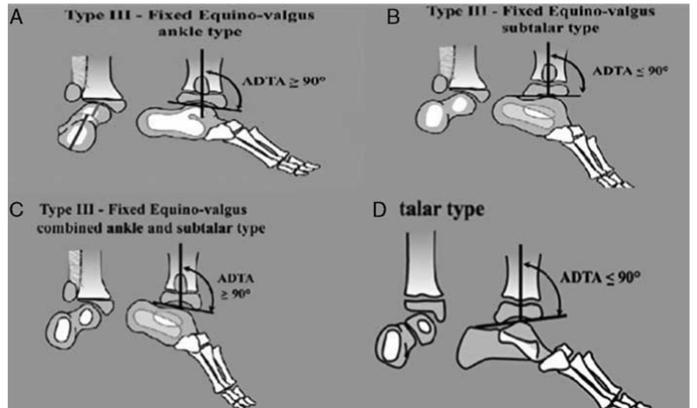 (PDF) Use of Paley Classification and SUPERankle Procedure in the ...