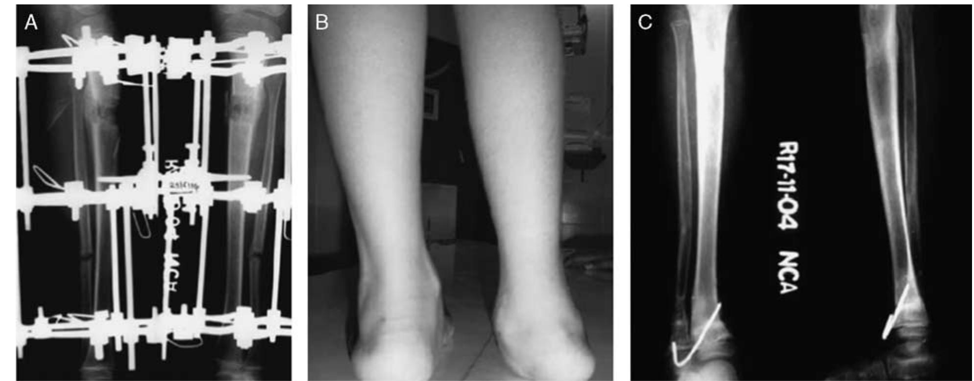Paley Alignment Method (PDF) Use of Paley Classification and SUPERankle Procedure in the ...