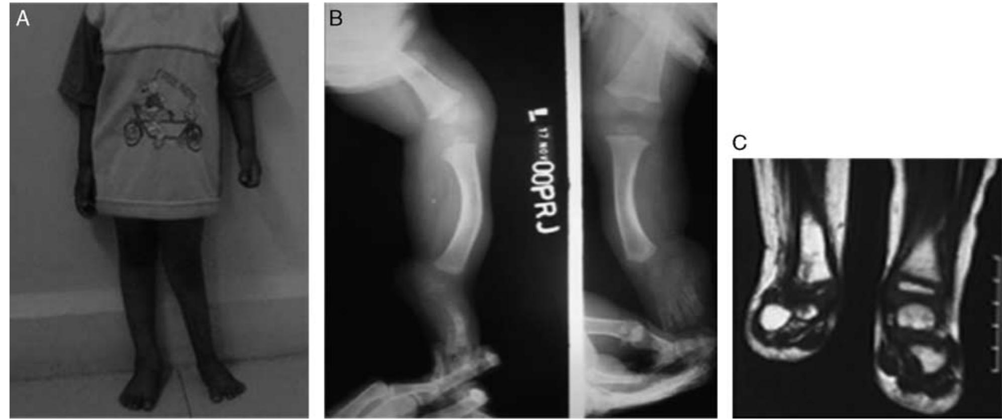(PDF) Use of Paley Classification and SUPERankle Procedure in the ...