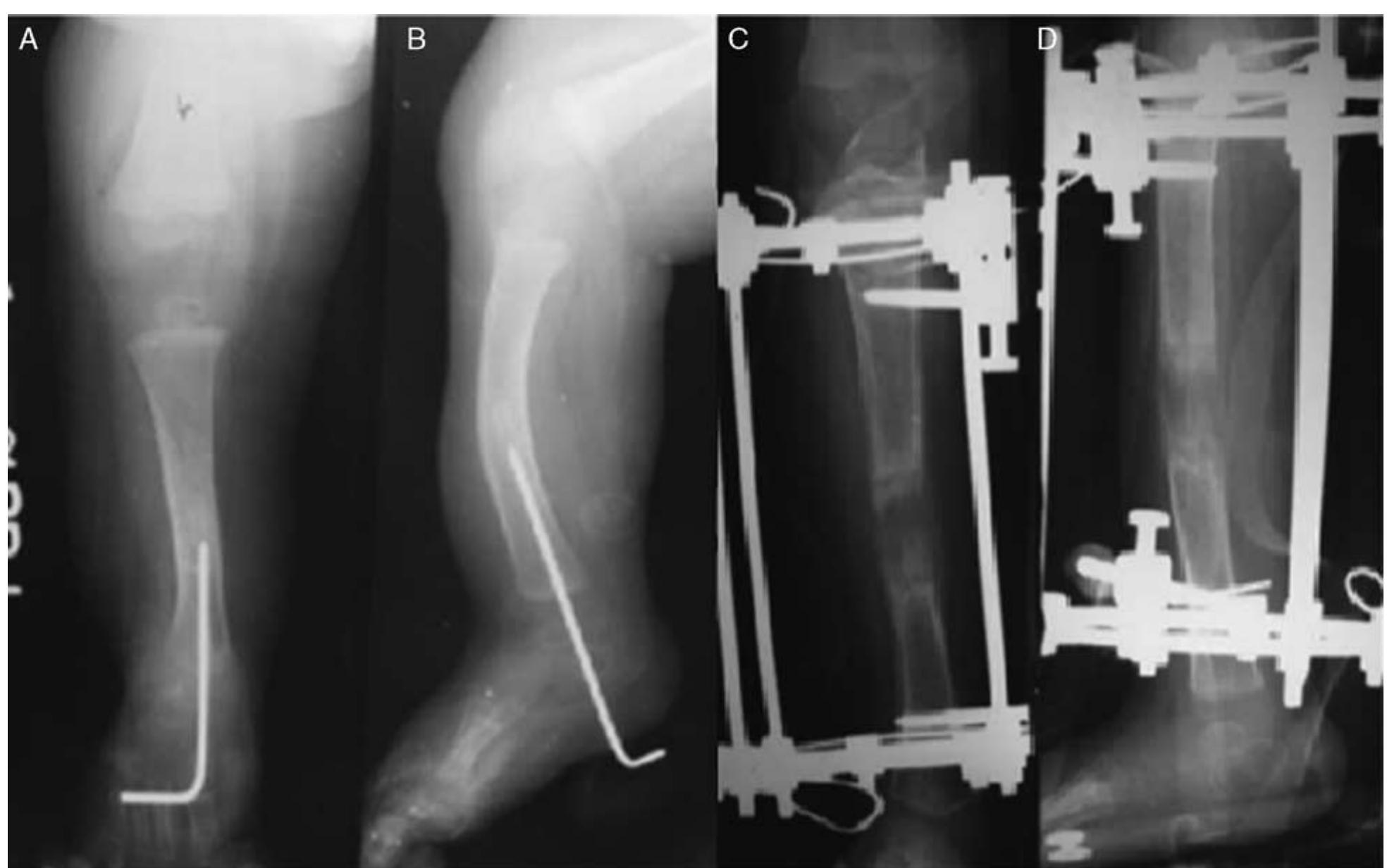 (PDF) Use of Paley Classification and SUPERankle Procedure in the ...