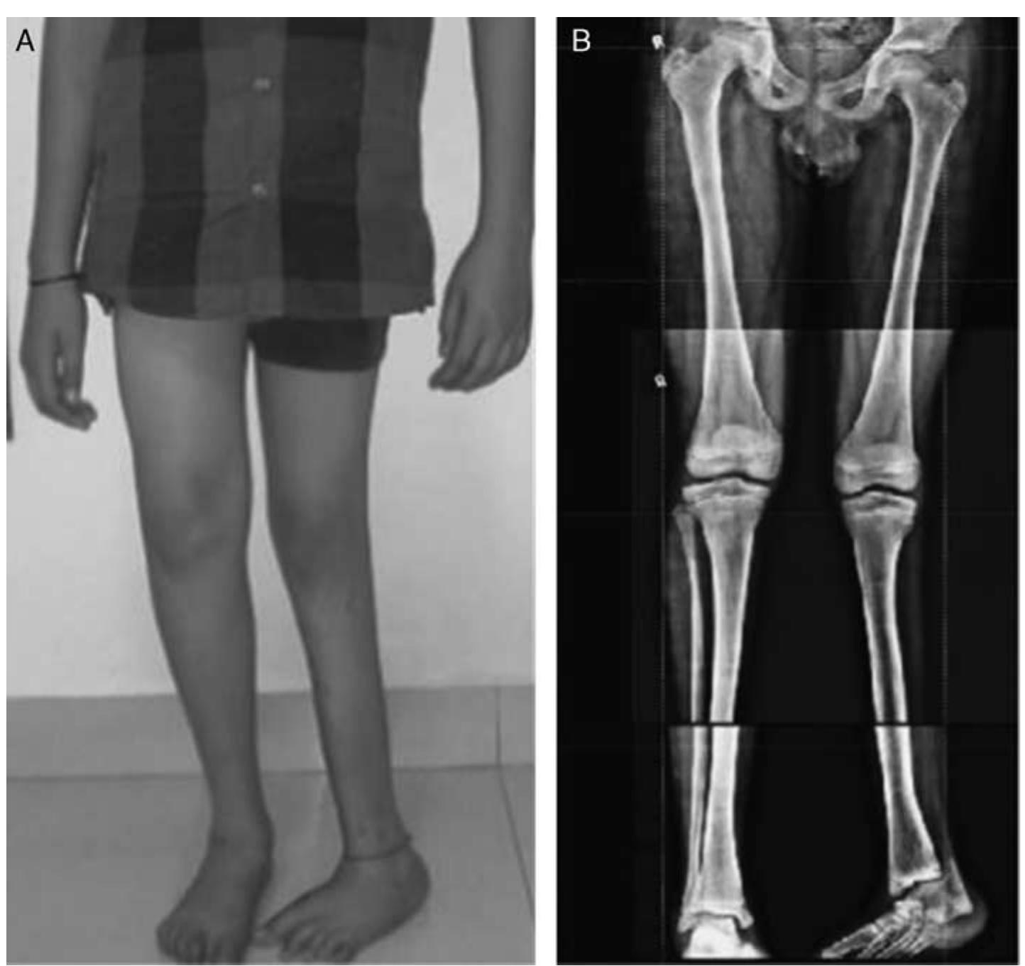 (PDF) Use of Paley Classification and SUPERankle Procedure in the ...