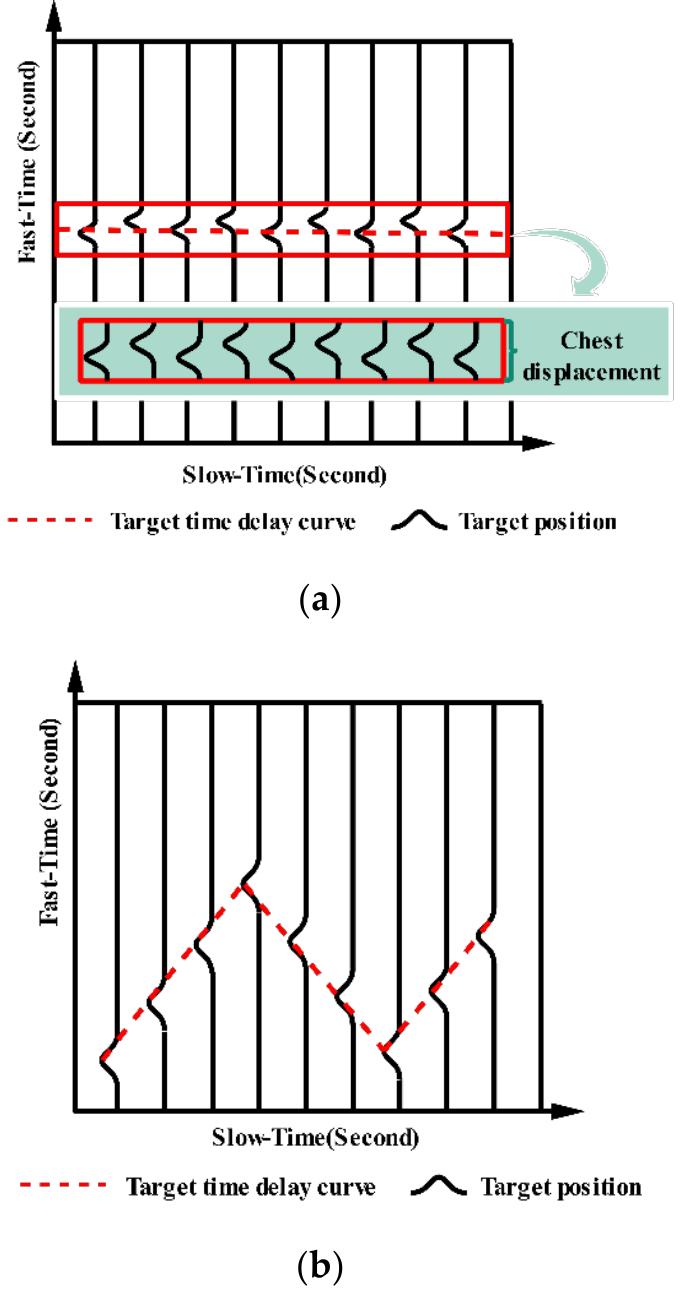 (PDF) The Overview of Human Localization and Vital Sign Signal ...