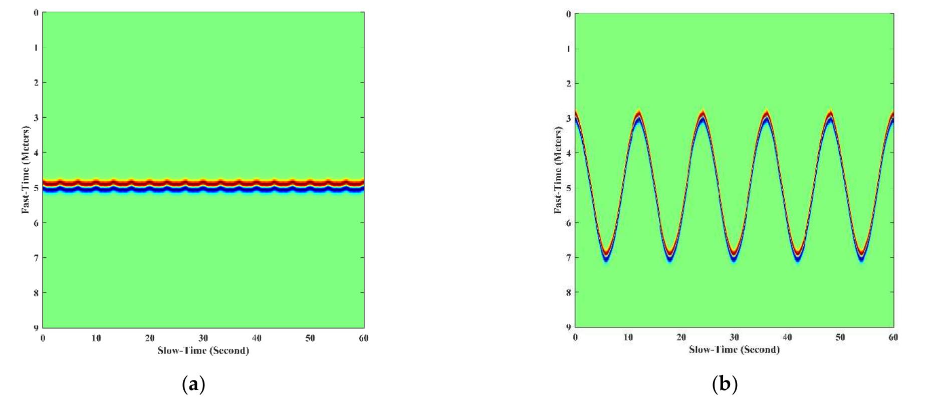 (PDF) The Overview of Human Localization and Vital Sign Signal ...