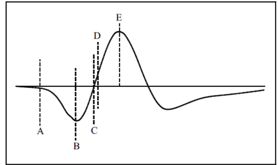 (PDF) The Overview of Human Localization and Vital Sign Signal ...
