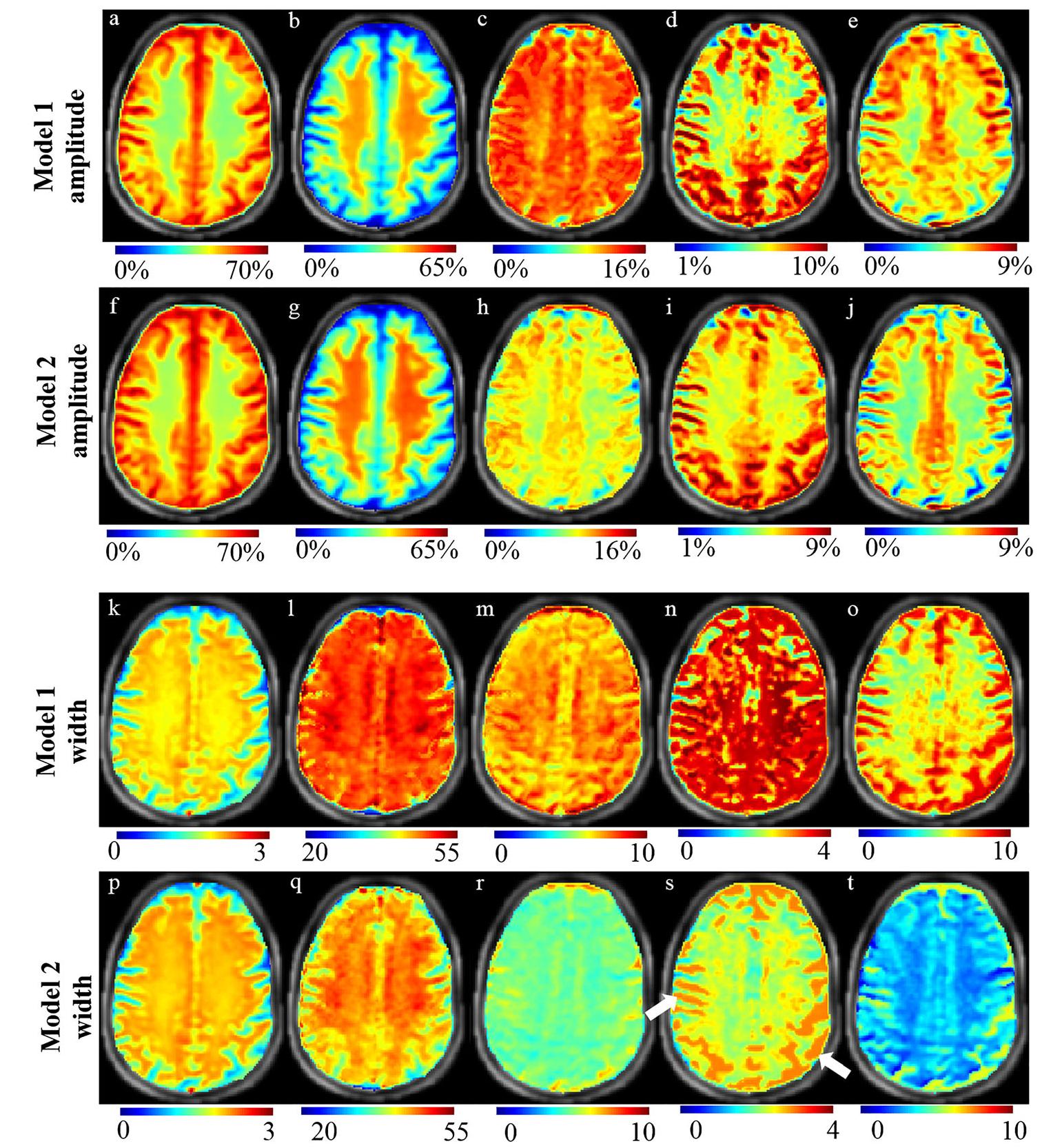 (PDF) Evaluating the feasibility of creatine‐weighted CEST MRI in human ...