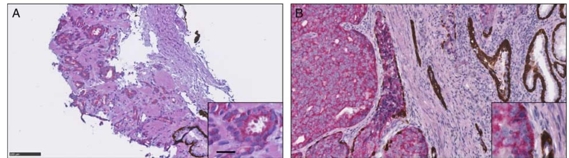 Counterstaining (PDF) Hematoxylin and Eosin Counterstaining Protocol for ...