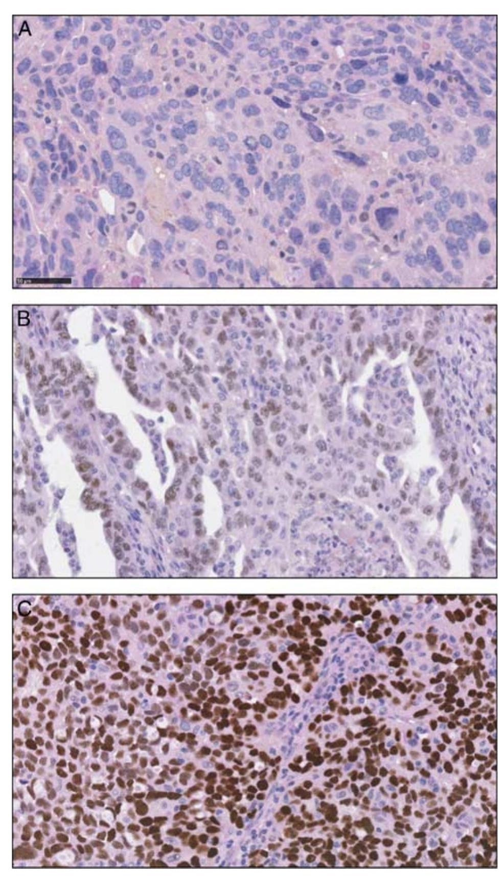 Counterstaining Figure 4 - from Hematoxylin and Eosin Counterstaining