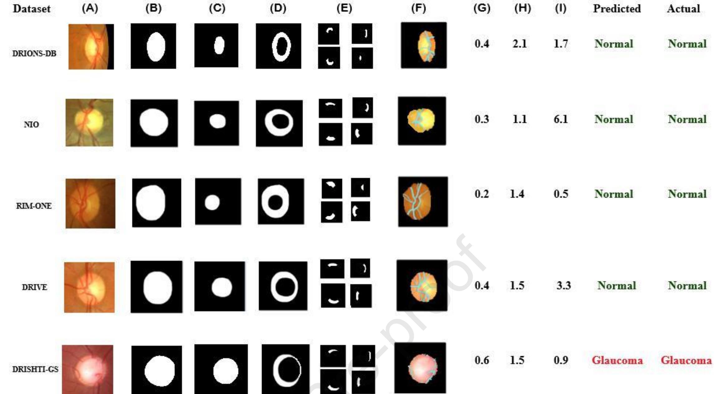 (PDF) Glaucoma detection in retinal fundus images using U-Net and ...
