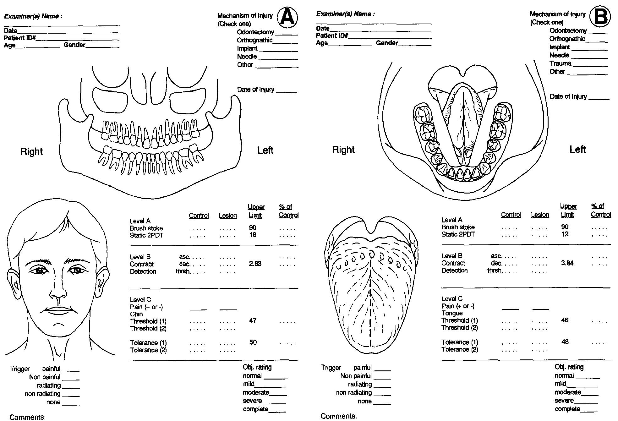 (PDF) The accuracy of clinical neurosensory testing for nerve injury ...