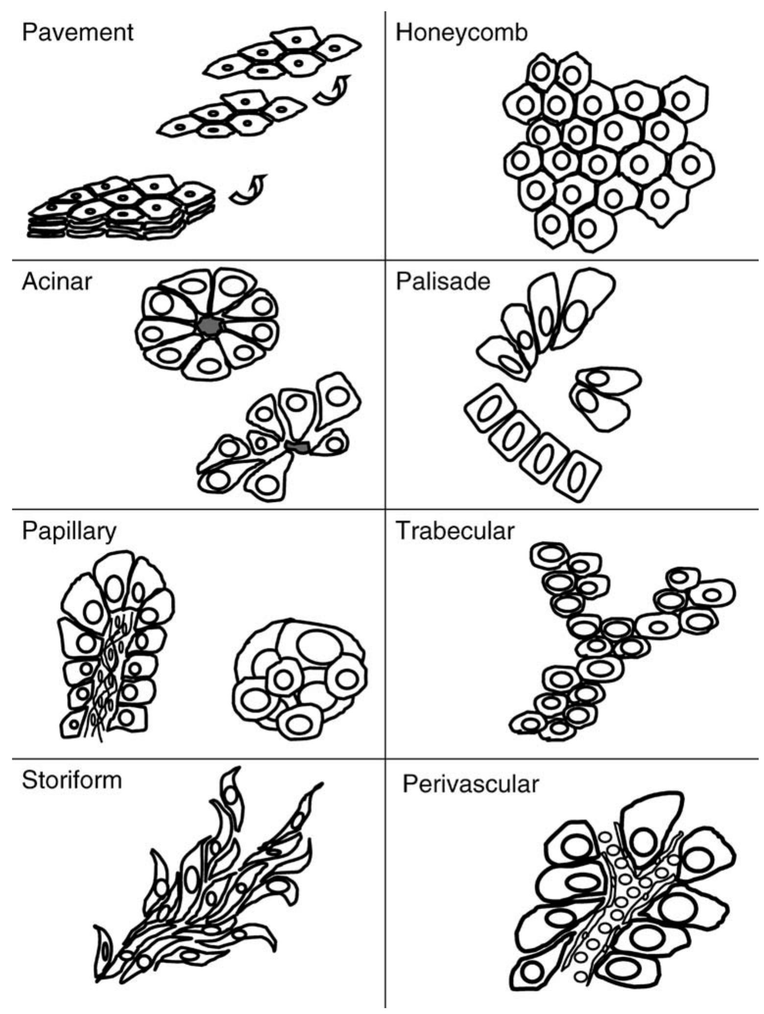 Figure 2 - from Architectural patterns in cytology: