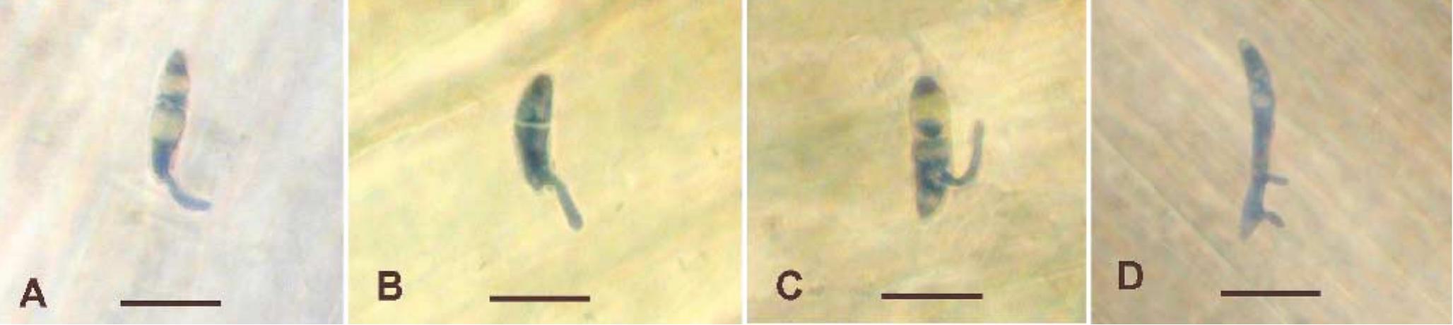 (PDF) The infection process of Colletotrichum graminicola and relative ...