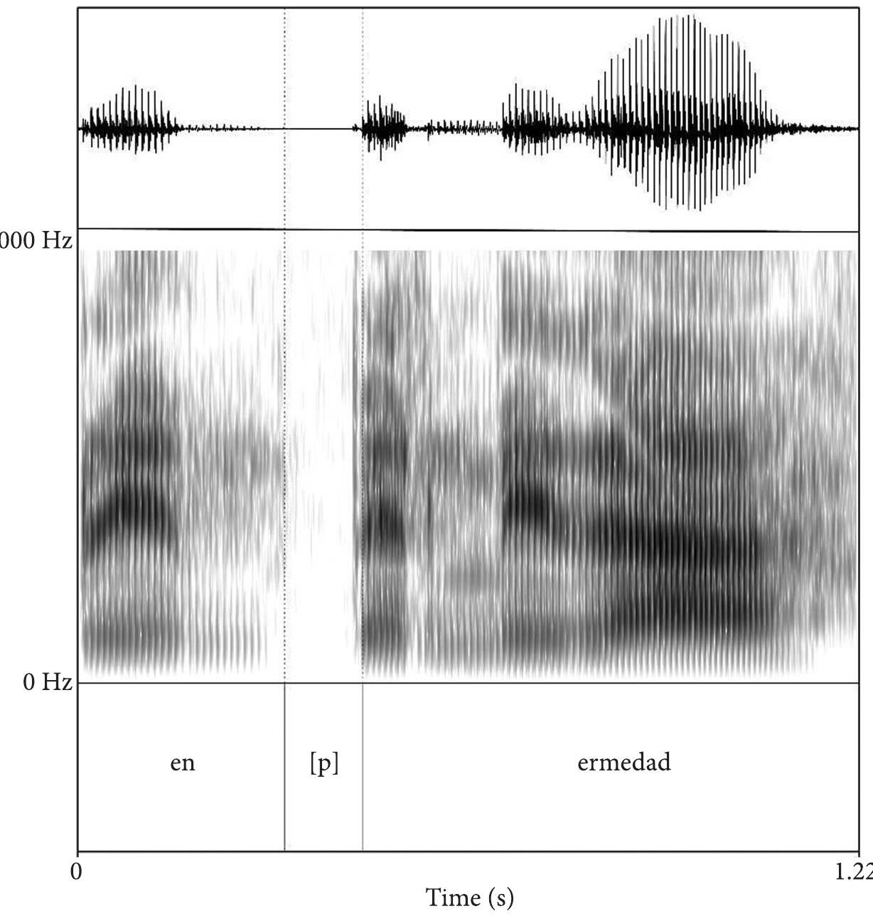 Figure 3. Waveform and spectrogram of the word enfermedad “sickness” with /f/ > [p] fortition, as produced by a Spanish-Mayan bilingual from Guatemala 