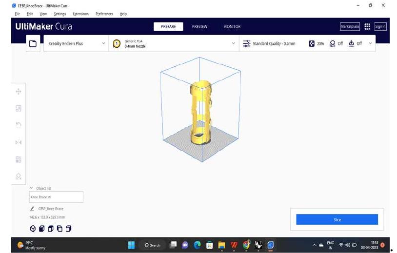 (PDF) Design and Simulation of Customized 3D Knee Braces to Enhance the ...