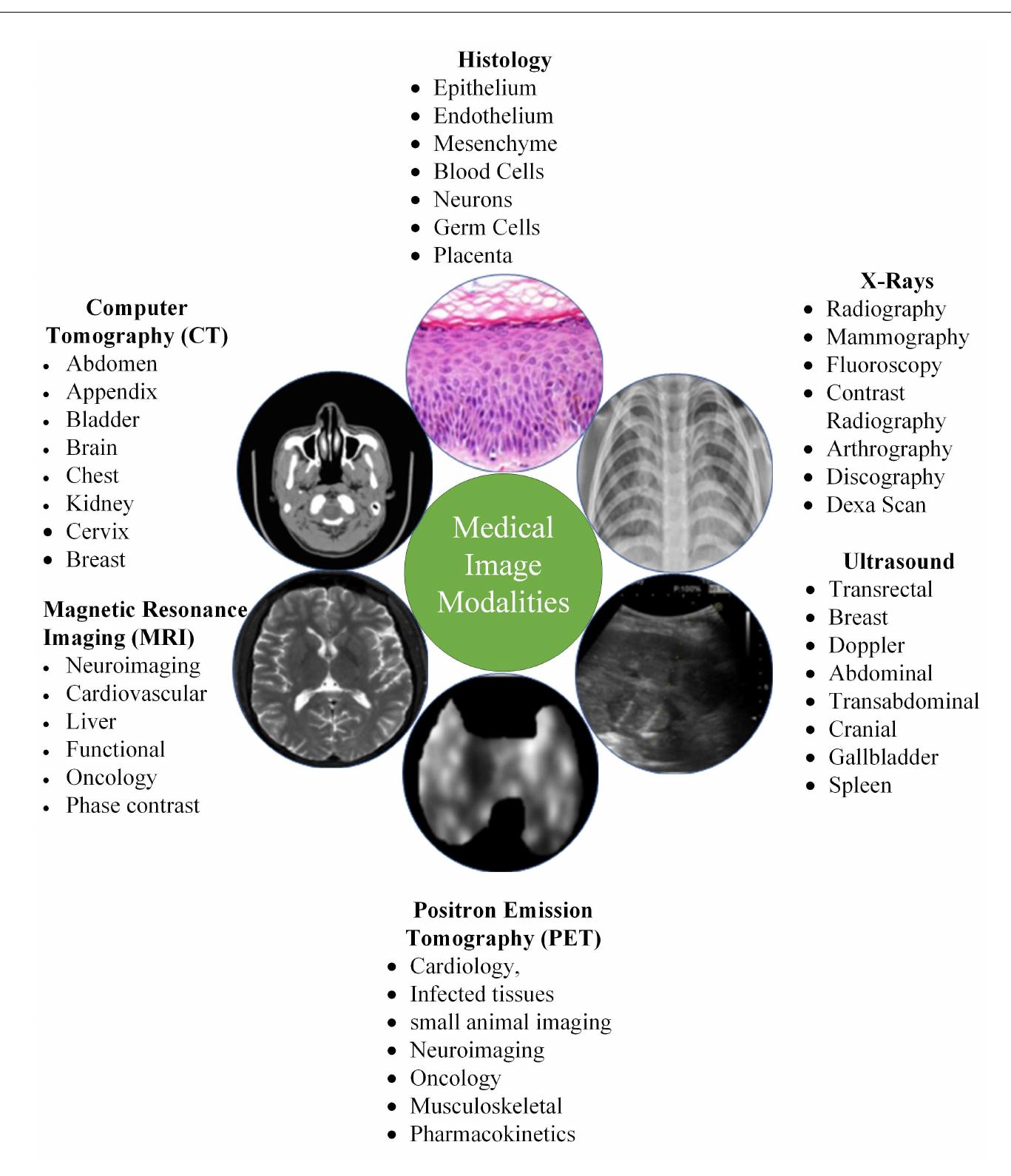 Medical Image Analysis using Convolutional Neural Networks: A Review  Fig. 1 Typology of medical imaging modalities. 