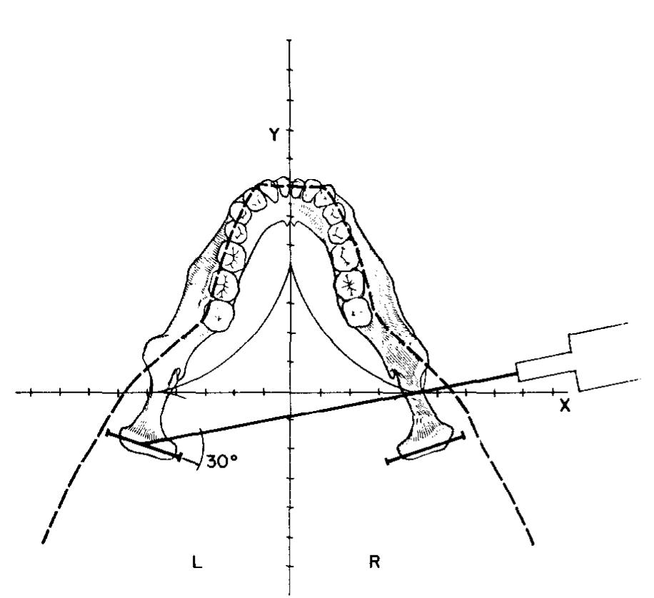 Tmj Radiograph Positioning (PDF) A new technique for imaging the temporomandibular joint with a ...