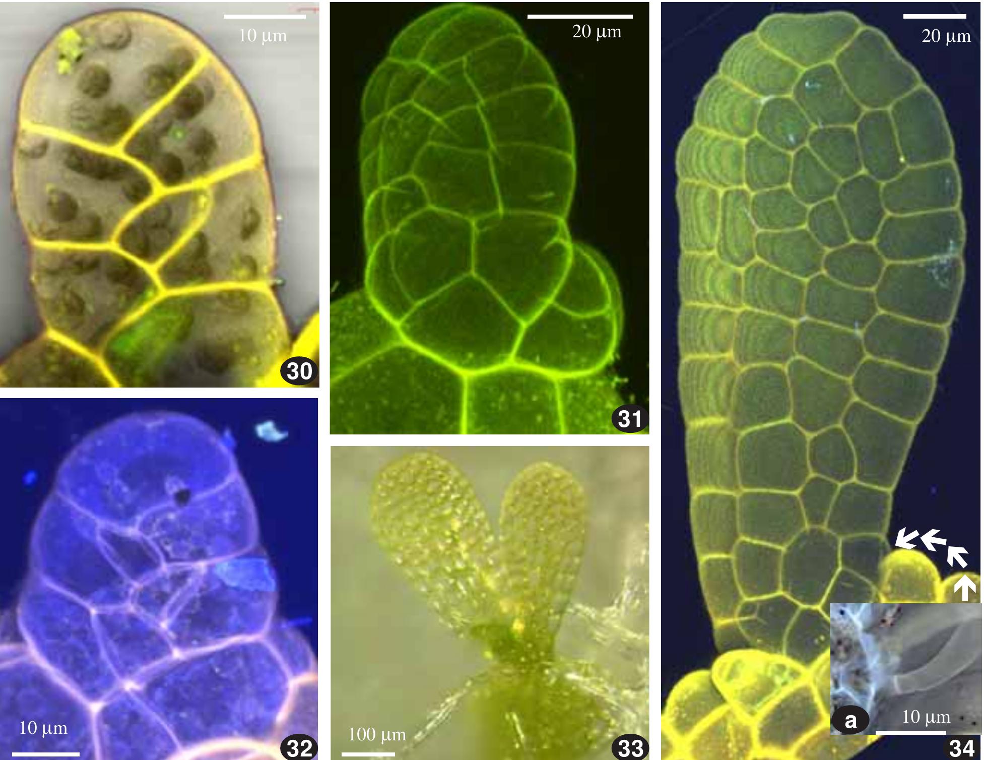 (PDF) On the leaf development in Oedipodium griffithianum ...