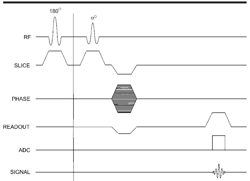 Mri Gradient Timing (PDF) MR Imaging Abbreviations, Definitions, and Descriptions: A Review