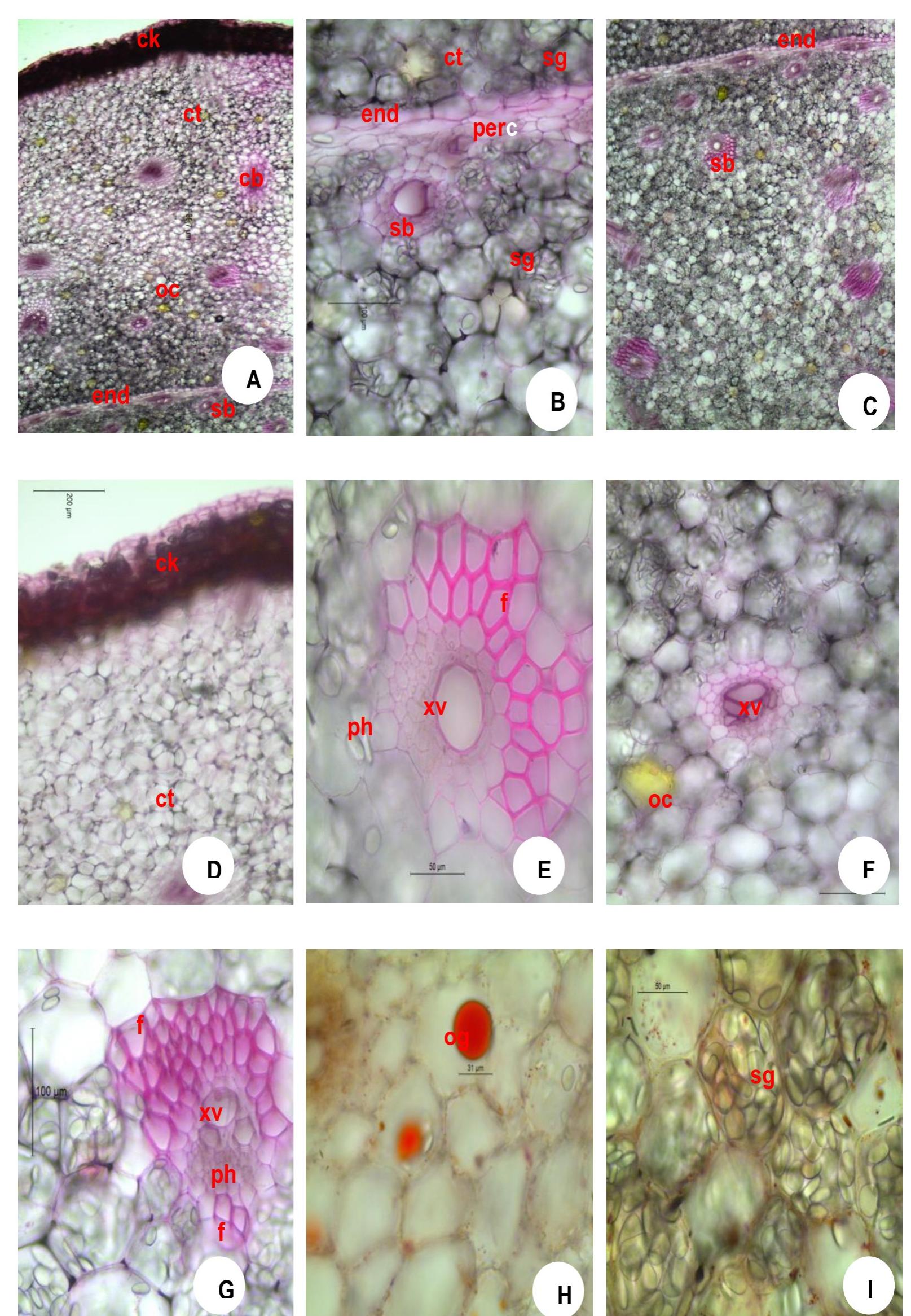 Ginger Microscope Figure 8 - from Histochemical analysis and storage behaviour