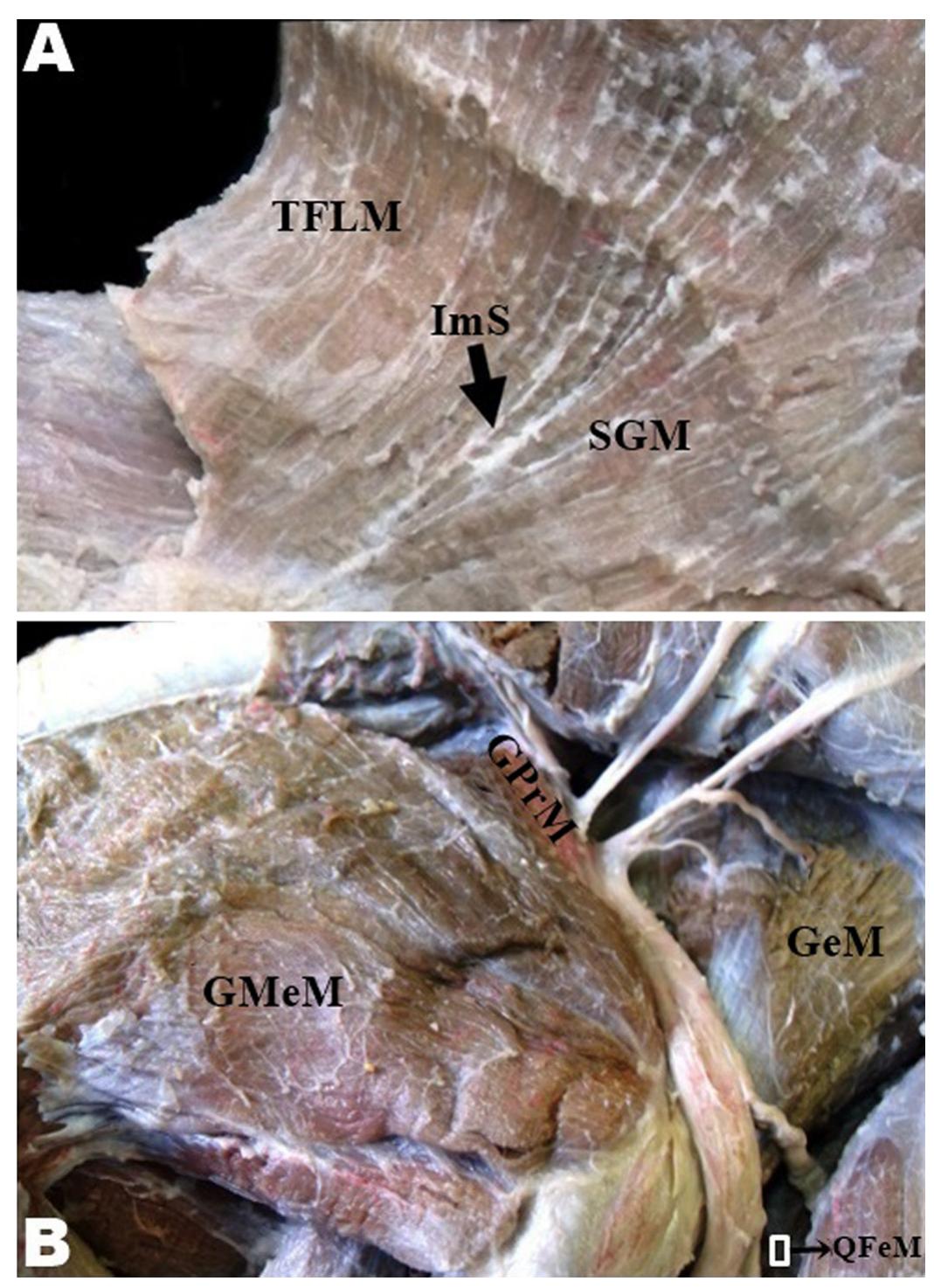 Figure 1 - Movement anatomy of the gluteal region and thigh