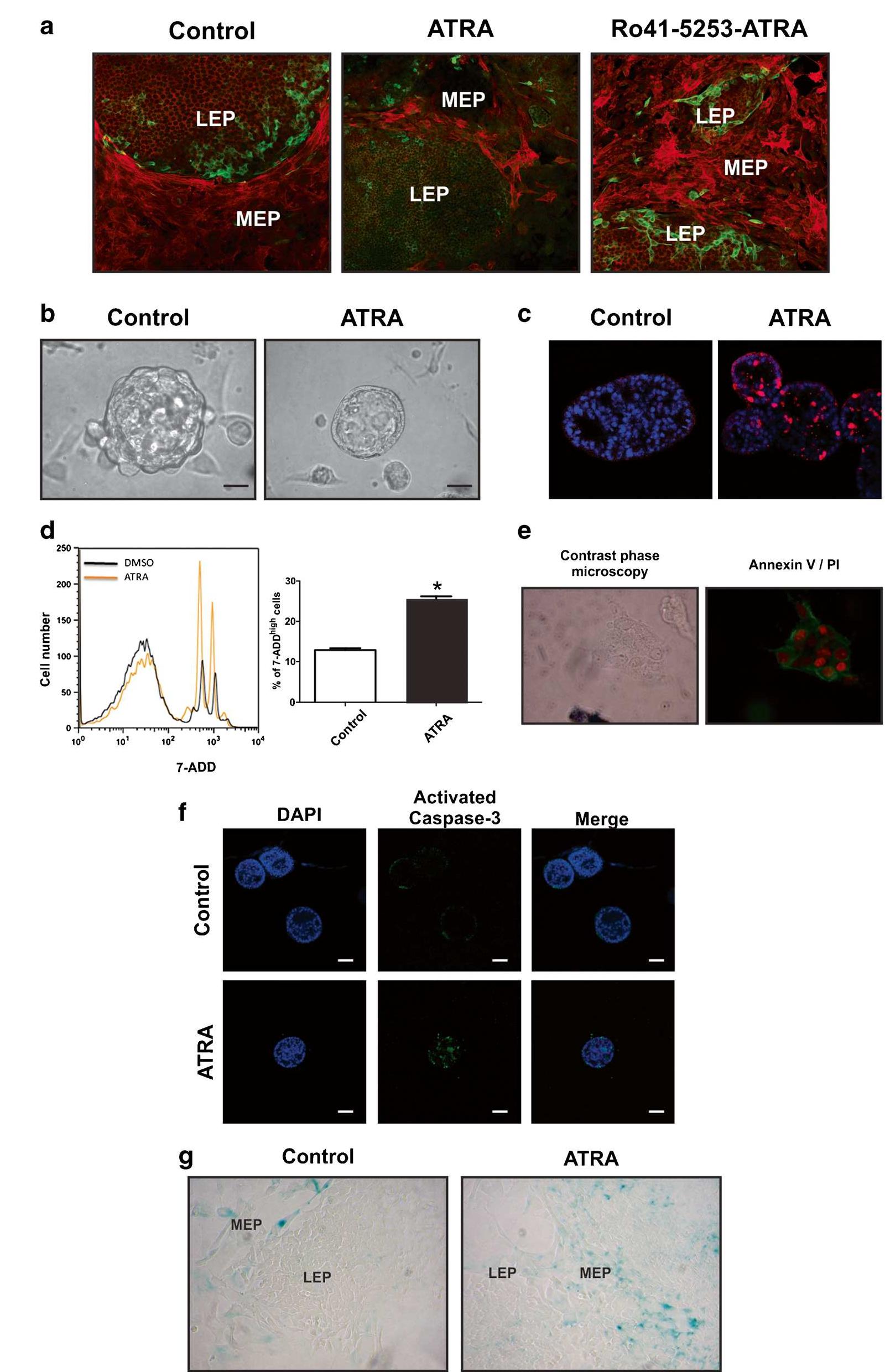 Lm38 (PDF) Myoepithelial and luminal breast cancer cells exhibit different ...