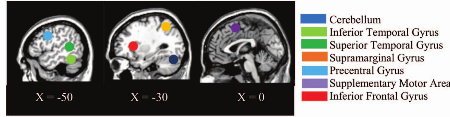 Schematic of the regions of interest used for the graphical