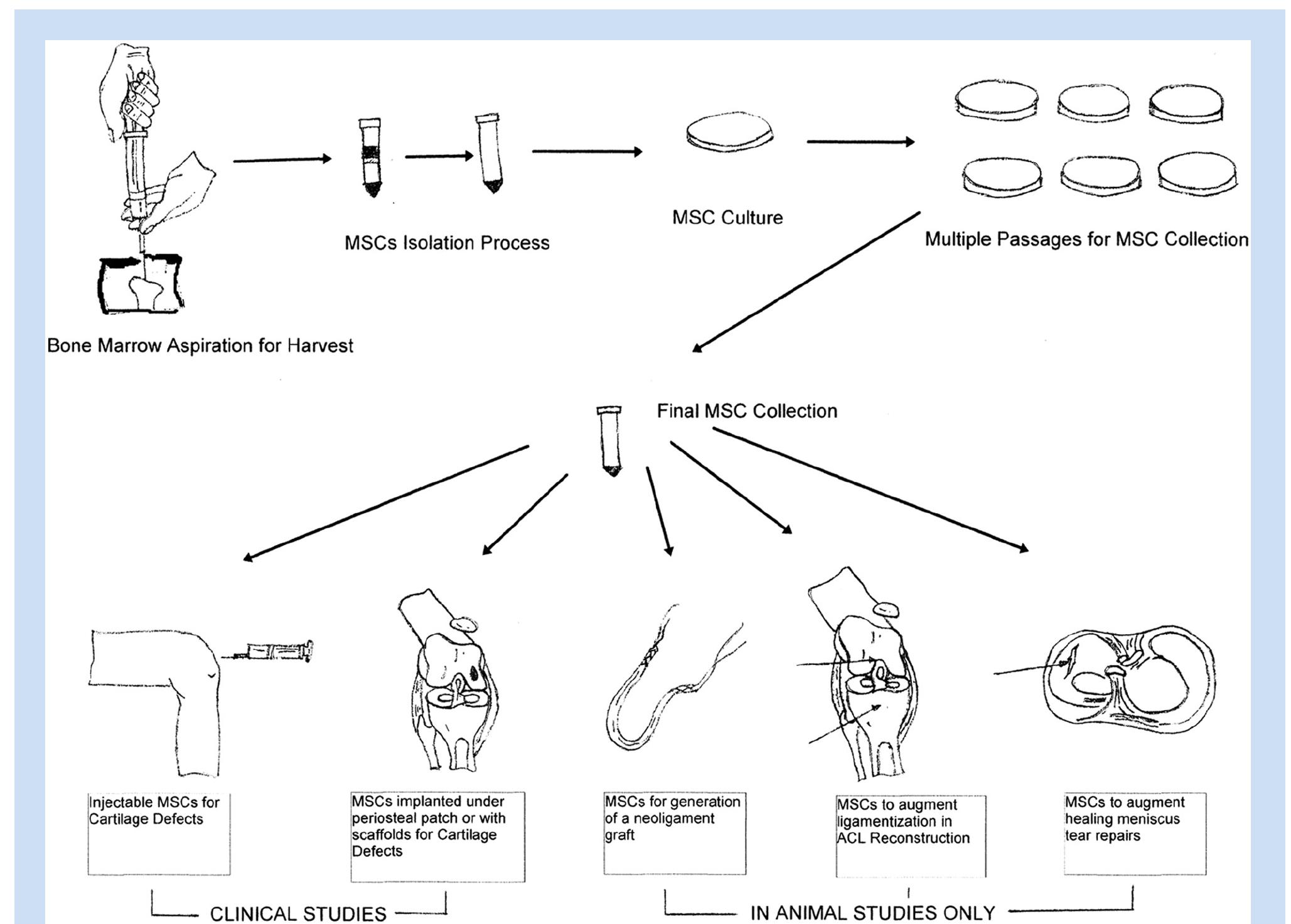 (PDF) Mesenchymal Stem Cell Therapy in the Sports Knee