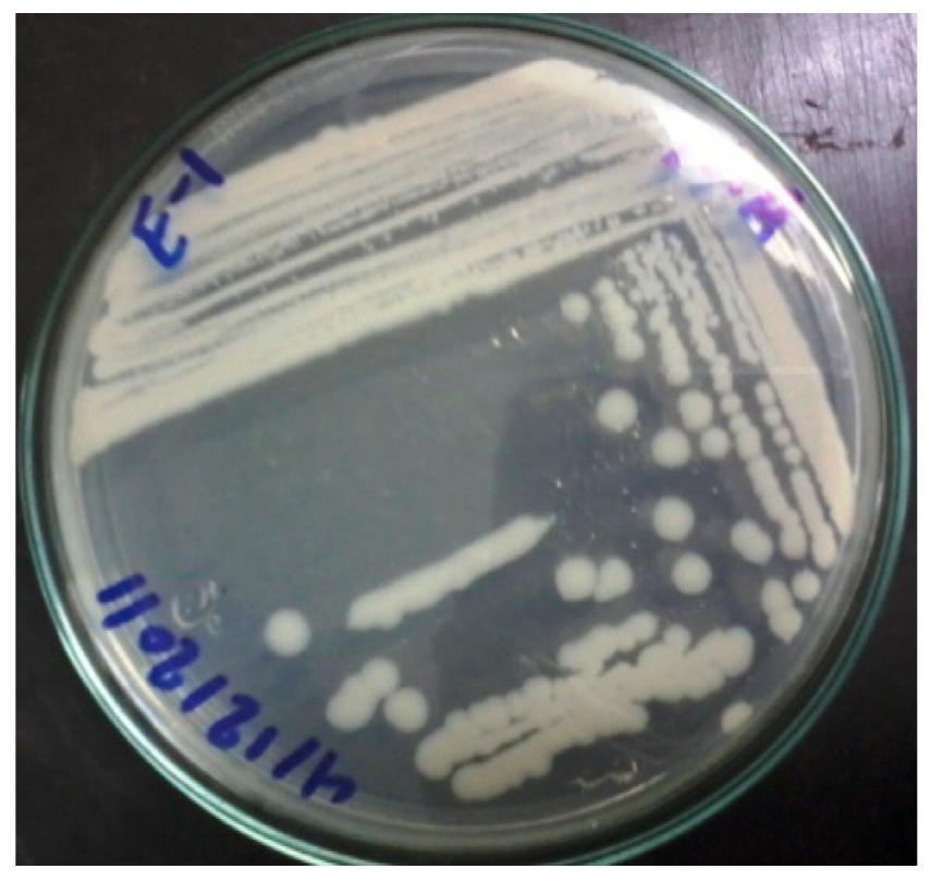 Fig. 1. Colony shape of B. Cereus.  Glucose, fructose, Sucrose, and pectin, cellulose and hemicelluolse were prepared by diluting each analyzed sugar deionized water. Injection volume of each standard was 10 pL. 