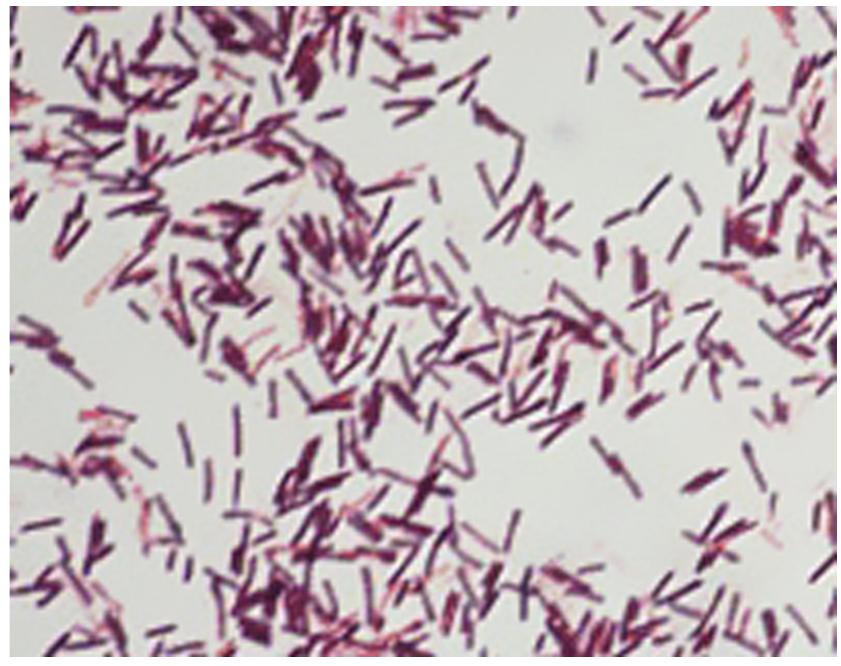 Fig. 2. Gram stain of B. cereus (1000X). 