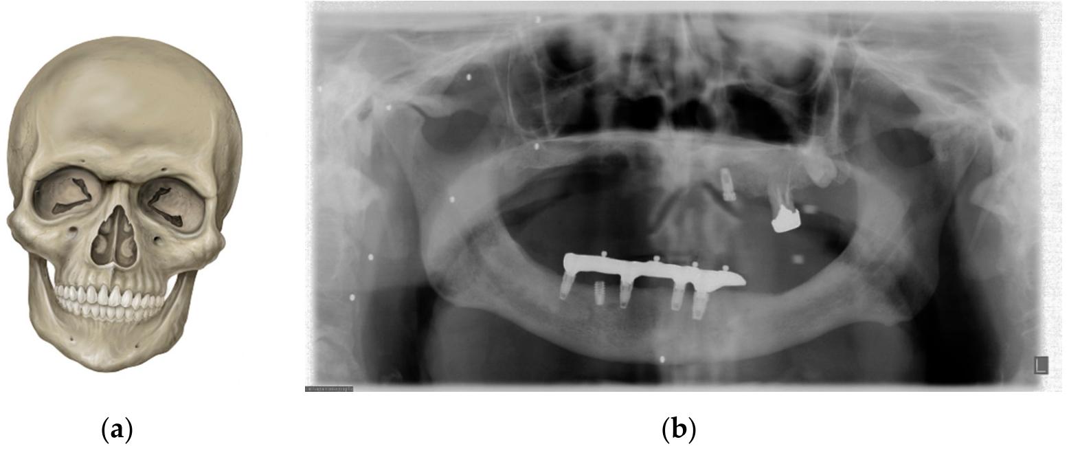 (PDF) Basic Knowledge and New Advances in Panoramic Radiography Imaging ...