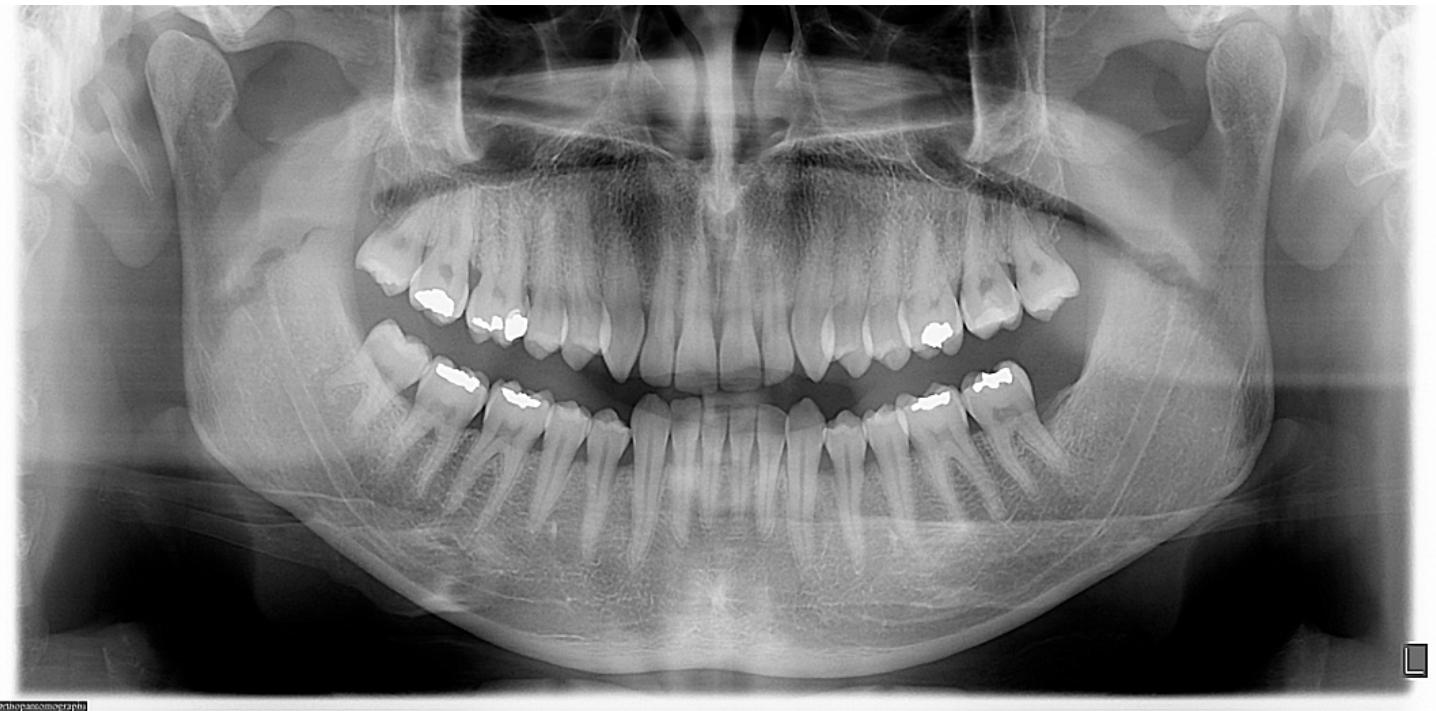 (PDF) Basic Knowledge and New Advances in Panoramic Radiography Imaging ...