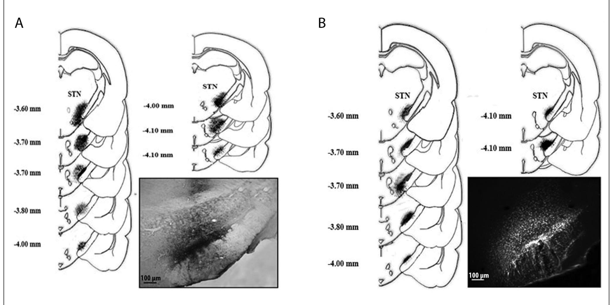 Schematic illustrations of injection sites to the stn. (a)