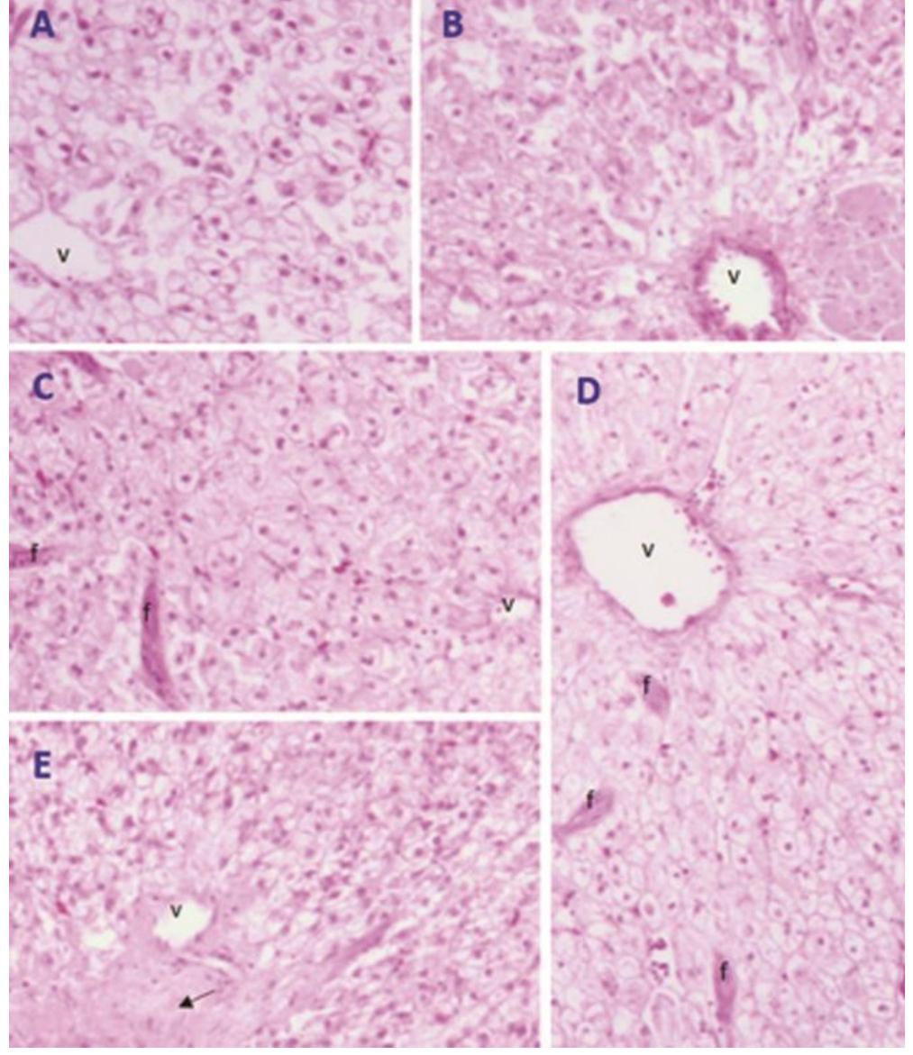 representative photos of the hepatic sections (100x; h &