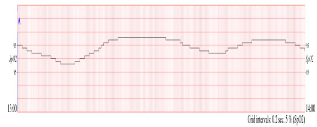 Figure 1. SpO2 record with OSA negative subject [12].  SpO, is the amount of oxygen being carried by the red blood cell in the blood. Very simply, SpO, goes up and down 