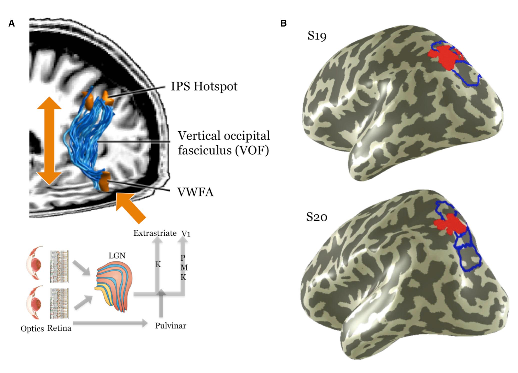 Visual Heading (PDF) Diagnosing the Neural Circuitry of Reading