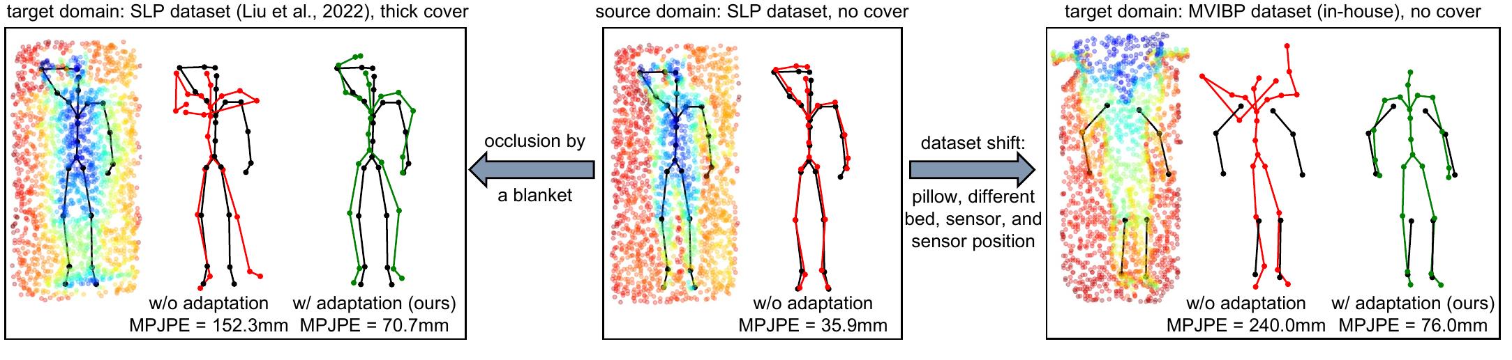 (PDF) Anatomy-guided domain adaptation for 3D in-bed human pose estimation