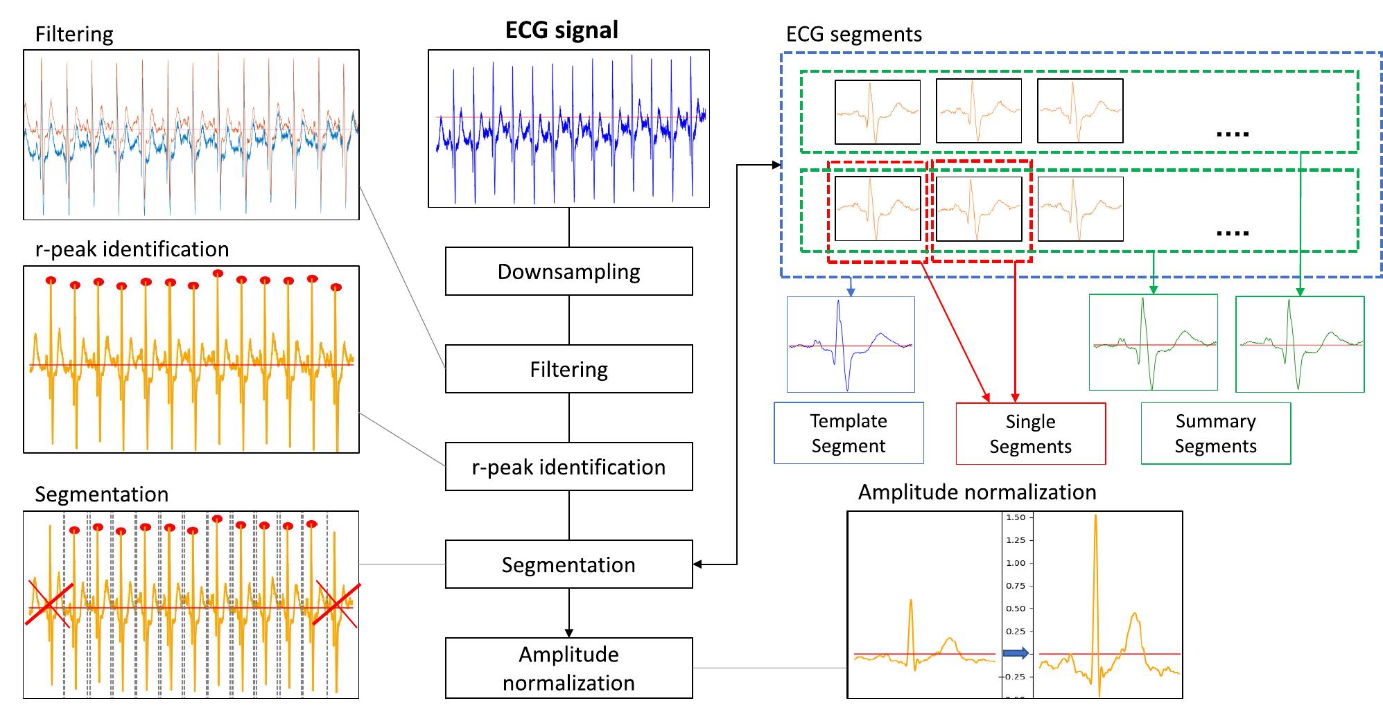 (PDF) ECG Biometric Recognition: Review, System Proposal, and Benchmark ...